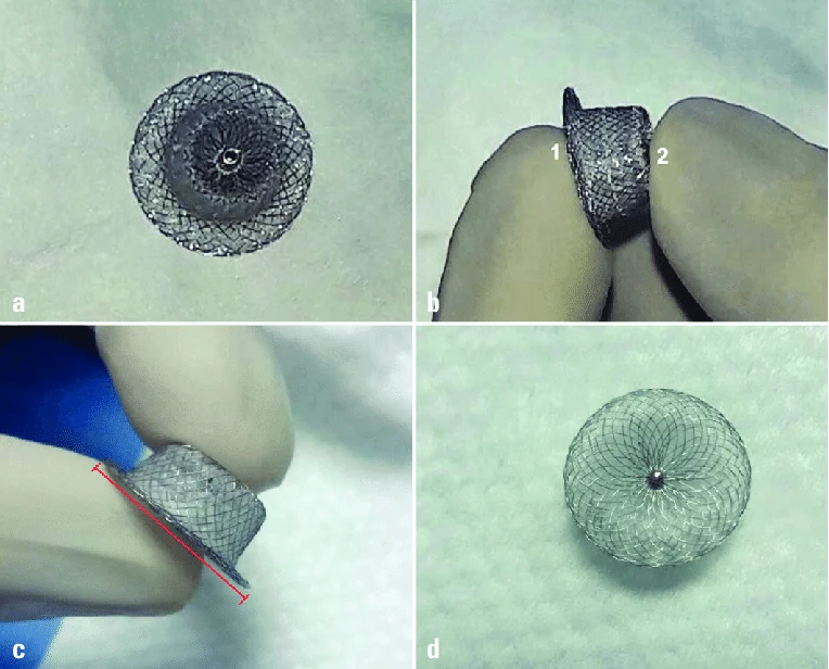 Four views showing the shape and Nitinol mesh of the Cocoon Duct Occluder