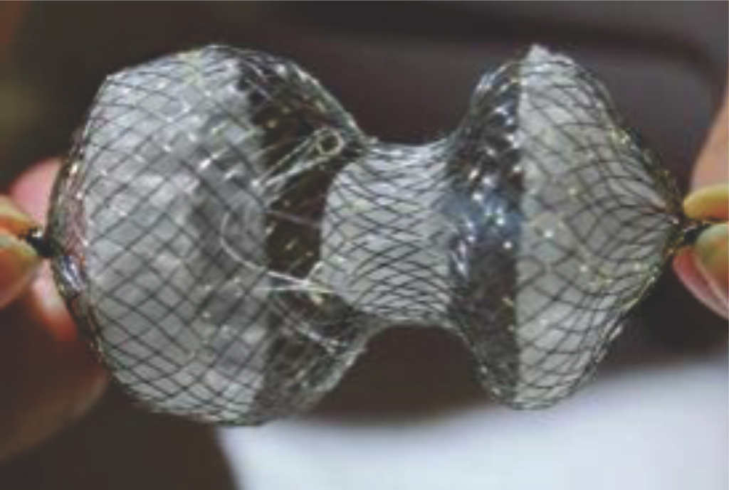 Detailed view of the double-disc Cocoon Septal Occluder