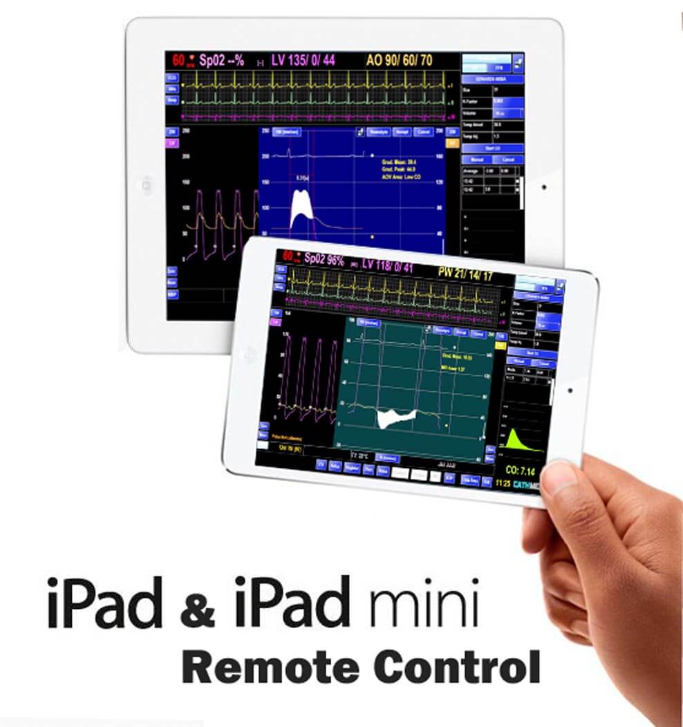 Remote Control via iPad™